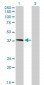 HFE Antibody (monoclonal) (M01)